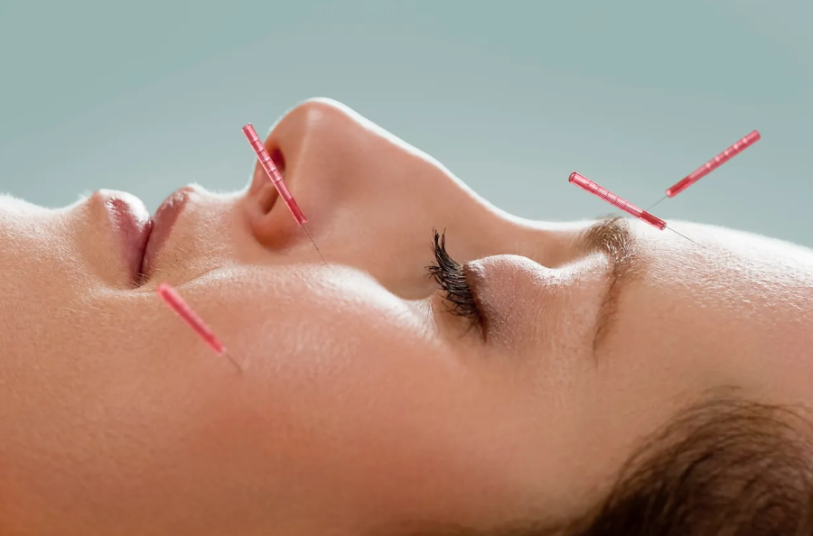 Perioral Dermatitis: Causes, Treatment, and Care Hacks